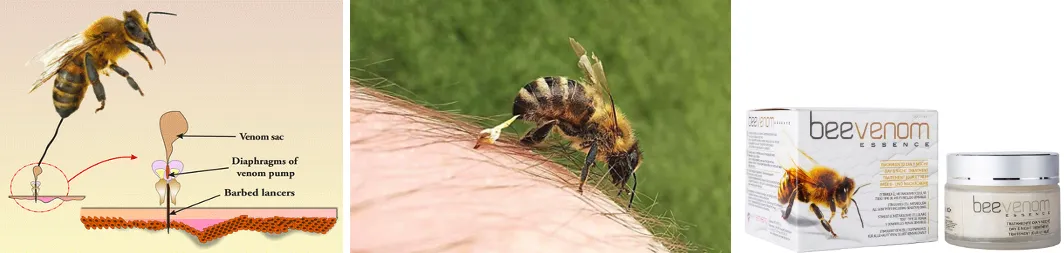Bee sting mechanism showing the venom apparatus and venom delivery during stinging