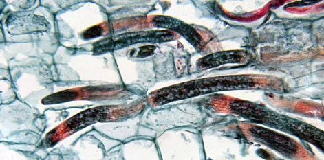 Radopholus similis burrowing nematode showing migratory endoparasitic body form