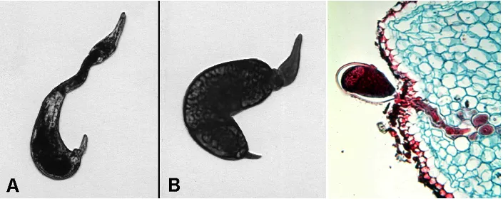 Citrus nematode Tylenchulus semipenetrans on feeder roots showing nurse cell formation