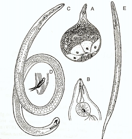 Figure 1: Meloidogyne sp. A. Female, B. Female Anterior Region, C. Male, D. Male Tail, E. Second Stage Juvenile