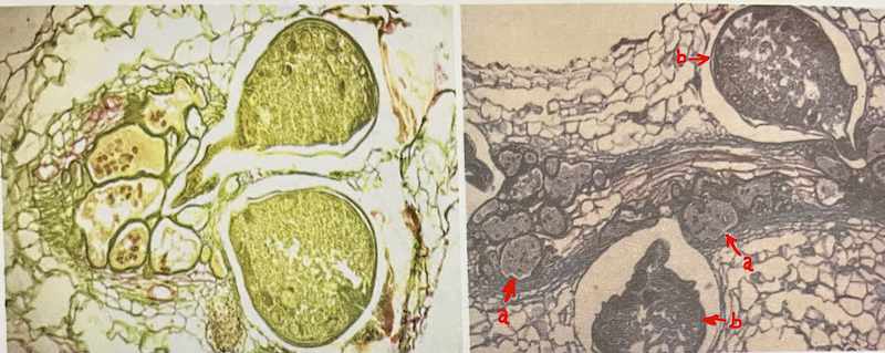 a. Giant cells, b. Nematode Meloidogyne spp.