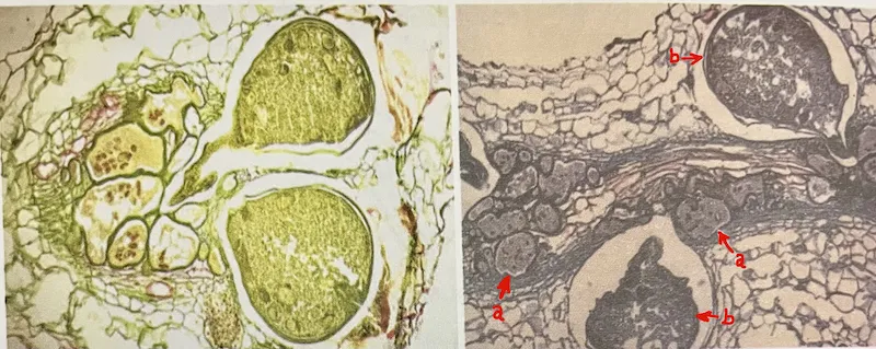 Root-knot nematode feeding site showing giant cells and embedded Meloidogyne in plant roots